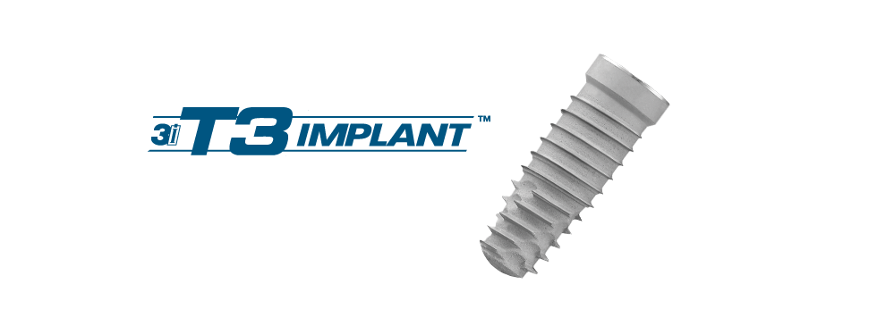 The 3i T3® Implant - DENTAL DEPOT